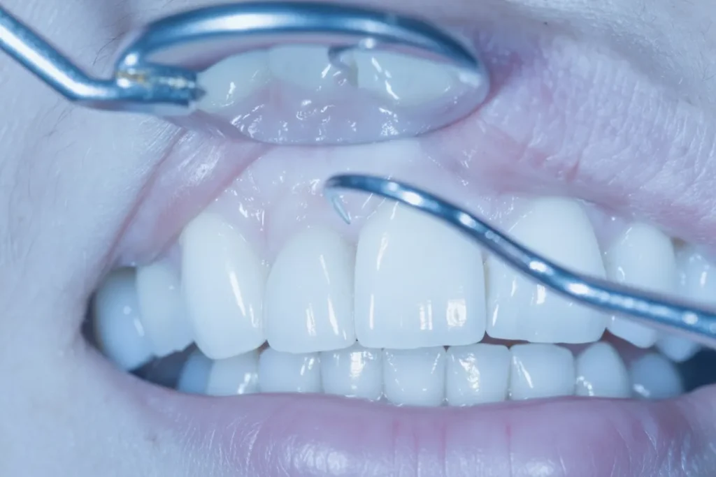 Best dentist in Scarborough providing family, cosmetic, restorative, and emergency dental care in a modern clinic.