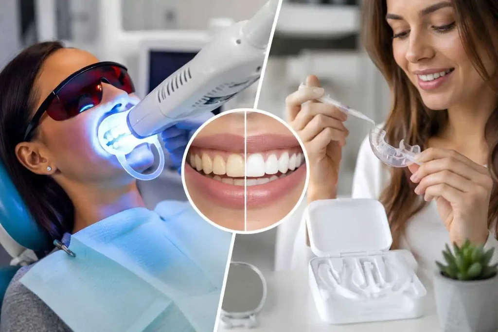 Professional Teeth Whitening vs At-Home Kits