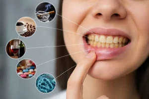 What Causes Yellow Teeth